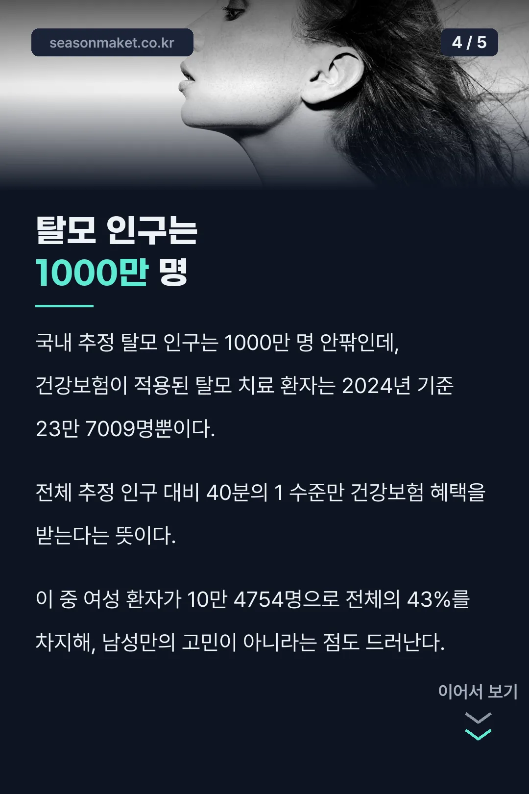 탈모 인구 숫자